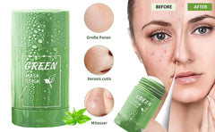 Magic Green Tea Stick Mask – Deep Cleansing & Oil Control Mud Mask for Acne, Blackheads & Tight Pores